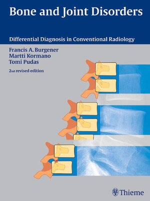 cover image of Bone and Joint Disorders